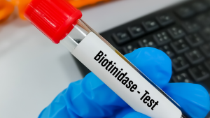 Vitamin H (Biotin) Testi