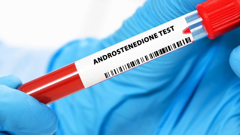 Androstenedion Testi