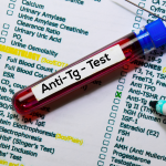 Anti TG Testi