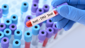 Anti TPO Testi