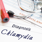 Chlamydia Trachomatis Antijeni Testi