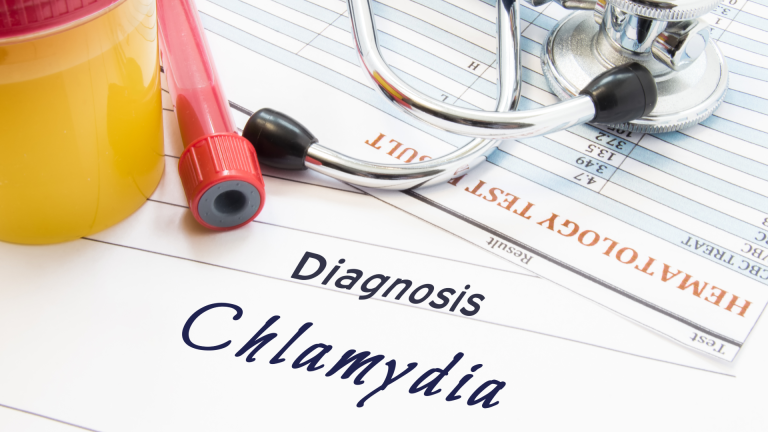 Chlamydia Trachomatis Antijeni Testi