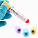 Chlamydia Trachomatis Antikoru IgG Testi