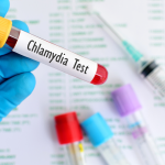 Chlamydia Trachomatis Antikoru IgM Testi