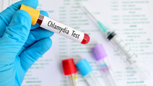 Chlamydia Trachomatis Antikoru IgM Testi