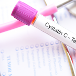 Sistatin C Testi