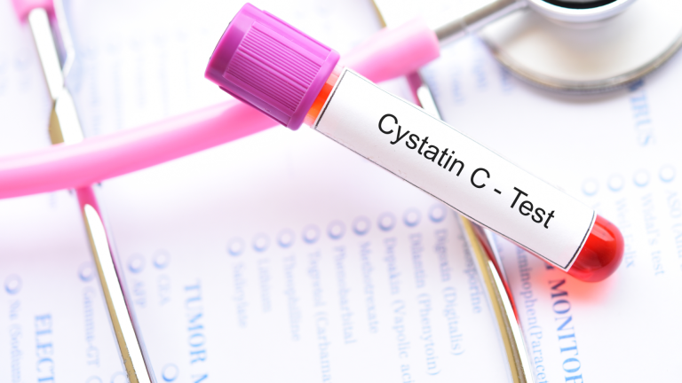 Sistatin C Testi