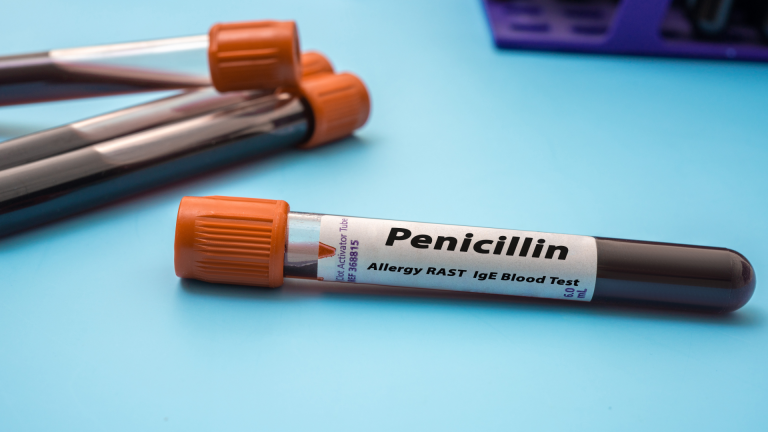 Sp IgE Penisilin Alerji Testi