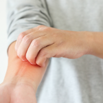 Sp IgE Soya Alerji Testi