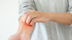 Sp IgE Soya Alerji Testi