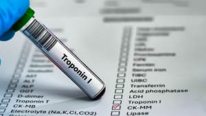 Troponin I Testi