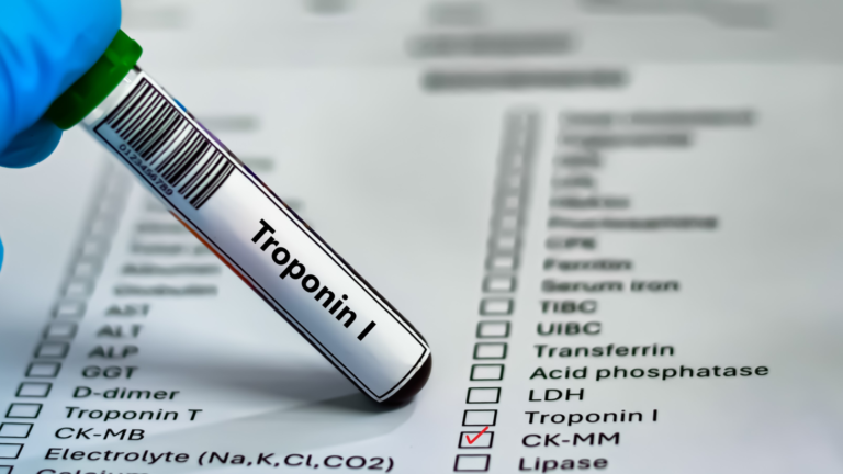 Troponin I Testi