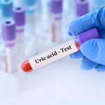 Ürik Asit Testi
