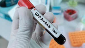 Anti GAD Testi