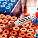 Bartonella Henselae IgG Testi