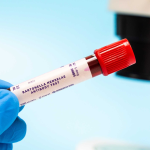 Bartonella henselae IgM Testi