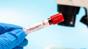 Bartonella henselae IgM Testi