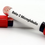 Beta 2 Mikroglobulin Testi
