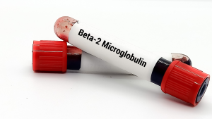 Beta 2 Mikroglobulin Testi