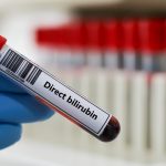 Bilirubin Direkt Testi