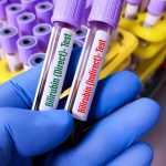 Bilirubin İndirekt Testi