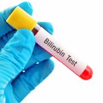 Bilirubin Total Testi