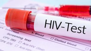 HIV Testi Ne Zaman Yapılır?