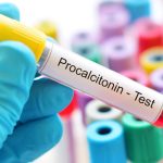 Prokalsitonin Testi