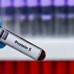 Protein S Aktivitesi