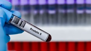 Protein S Aktivitesi