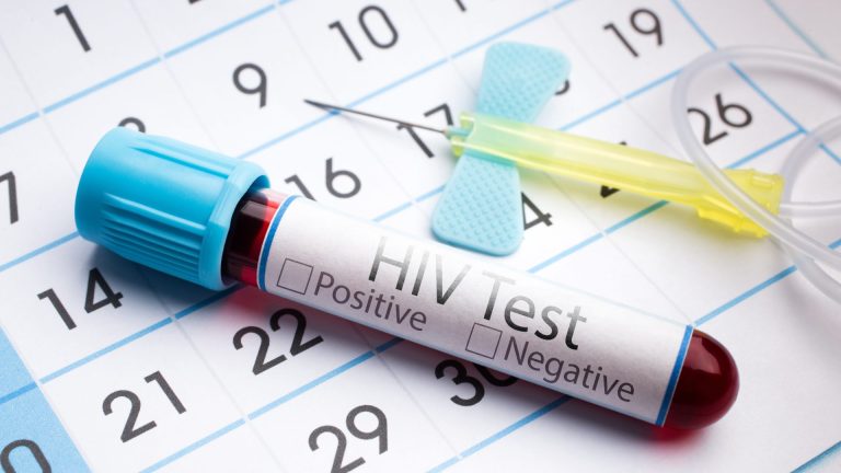 Şüpheli Temastan Sonra HIV Testi Ne Zaman Yapılır?
