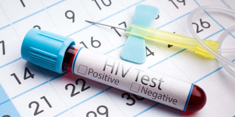 Şüpheli Temastan Sonra HIV Testi Ne Zaman Yapılır?
