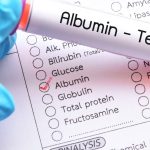 Albumin Testi