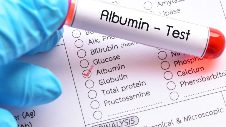 Albumin Testi