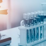 Beta-2 Glikoprotein 1 IgM Testi