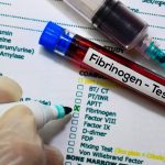 Fibrinojen Testi