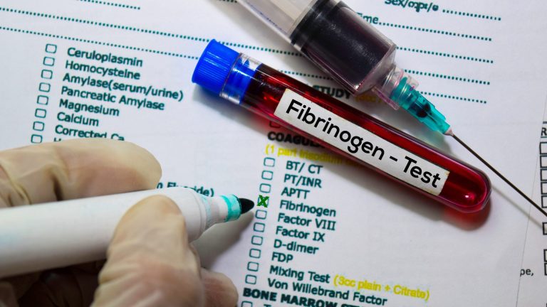 Fibrinojen Testi
