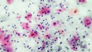 Gardnerella Vaginalis Testi