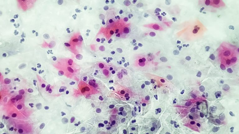 Gardnerella Vaginalis Testi