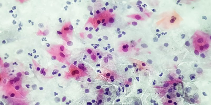 Gardnerella Vaginalis Testi