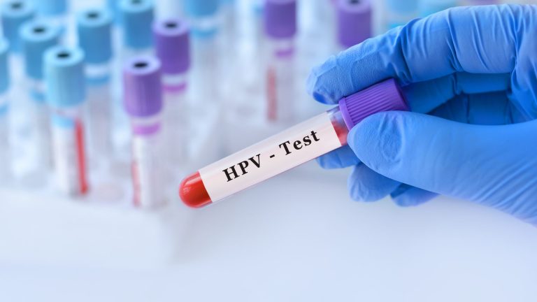 HPV Kan Testinde Çıkar Mı?