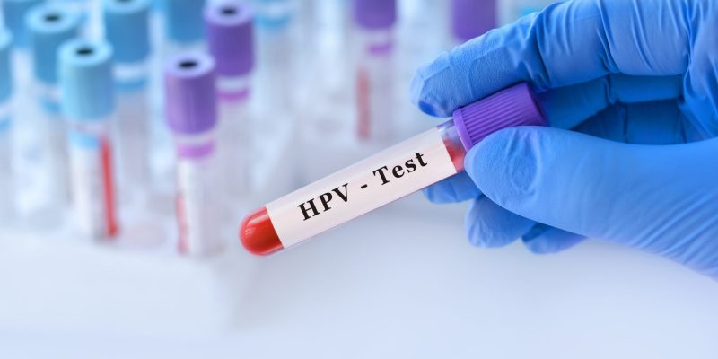 HPV Kan Testinde Çıkar Mı?