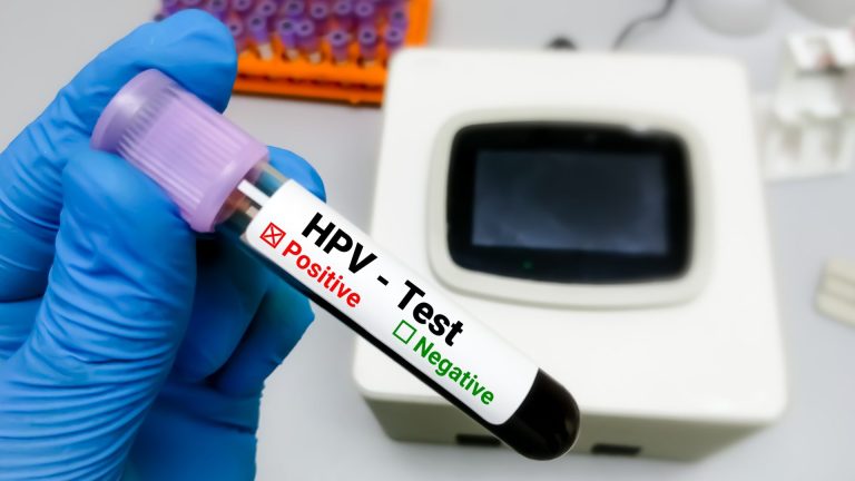 HPV Ne Zaman Belli Olur?