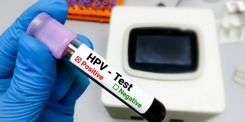 HPV Ne Zaman Belli Olur?