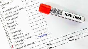 HPV Negatif Ne Demek?