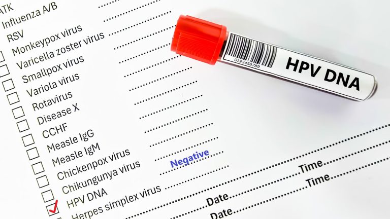 HPV Negatif Ne Demek?