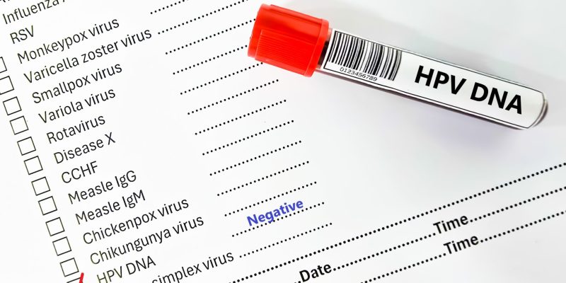 HPV Negatif Ne Demek?