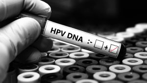 HPV Pozitif Ne Demek?