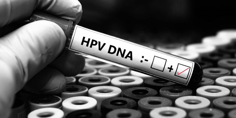 HPV Pozitif Ne Demek?