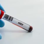 HSV Tip 2 IgG Testi